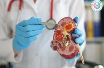 Kidney demonstration model.